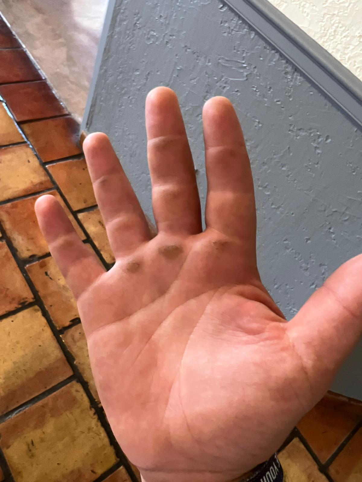 Callus